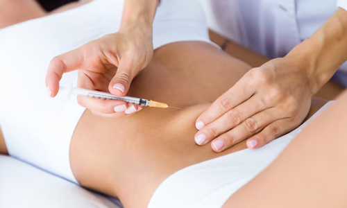 What-Is-Liposuction