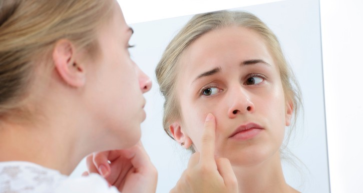 Some Acne Products Can Trigger Severe Allergic Reactions