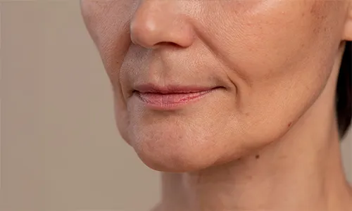 How to Hide Mouth Wrinkles