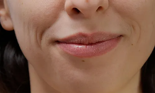 How to Disguise Lip Lines