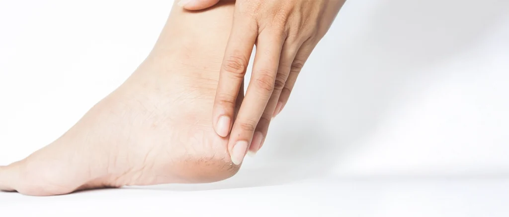 Home Remedy For Cracked