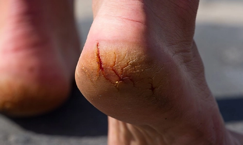 When To See A Doctor