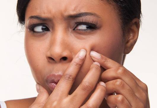 7 Worse Mistakes we make when we have zits-Popping pimples