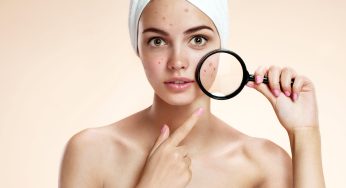 8 Surprising things that make your skin break out!