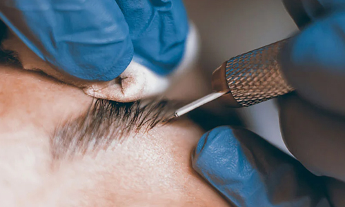 Who-Can-Undergo-the-Microblading-Process