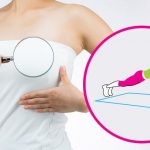 How To Get Firm And Perky Breasts