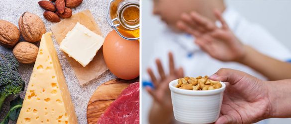 Dealing with Food Allergies