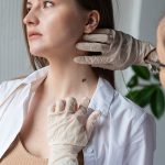 How to Know If a Mole Is Dangerous