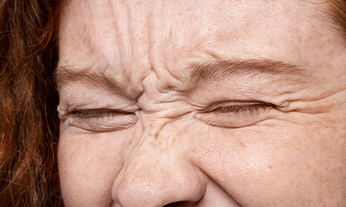 Wrinkles on Face