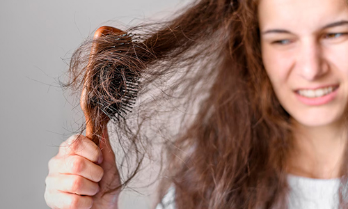 What-Does-Hair-Loss-from-Stress-Look-Like