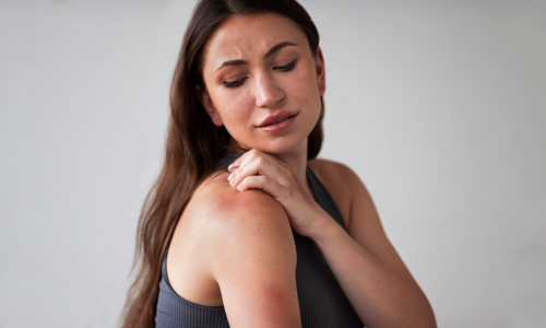 A woman suffering from itching and redness