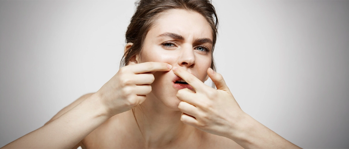 Zit Spot Treatment: 7 Mistakes That Make Acne Worse