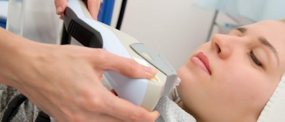 Laser Hair Removal