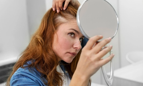 Woman checking her scalp and hair loss condition before consultation